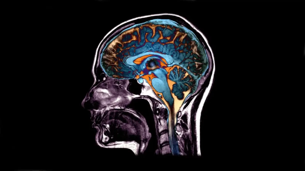 Vrásky na mozku aneb jak nám stárne mozek